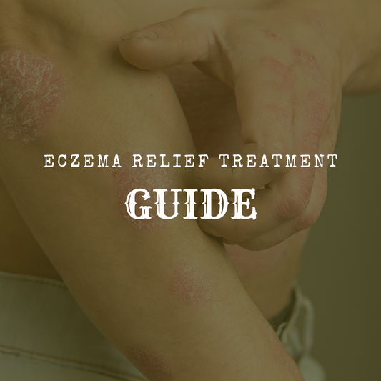 Eczema Relief Treatment Guide